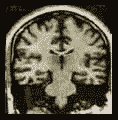 i3mifot01.gif (5294 bytes)